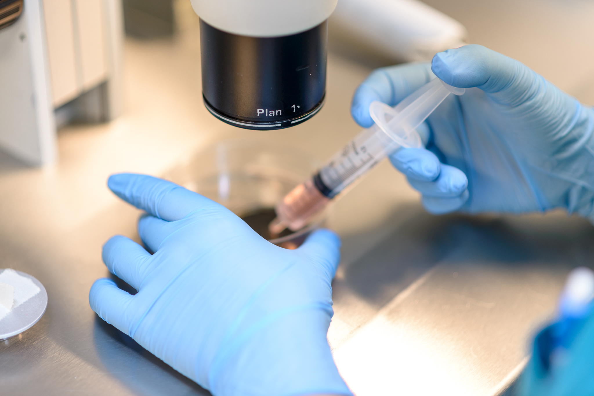 Khoa hiến muộn IVF 6
