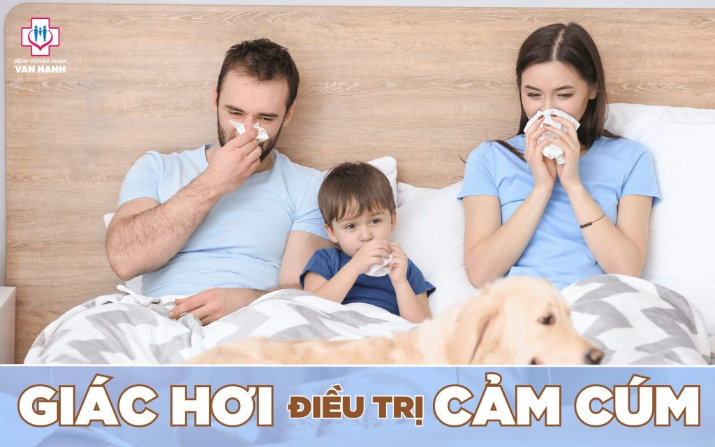 giác hơi điều trị cảm cúm
