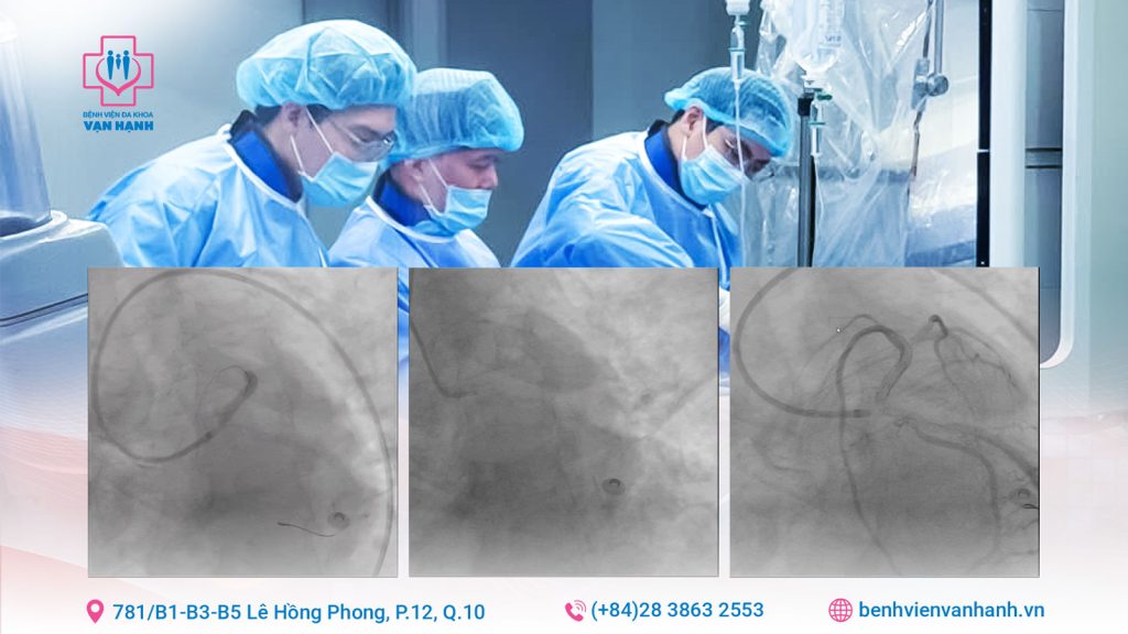 nhồi máu cơ tim trên bệnh nhân thận mạn