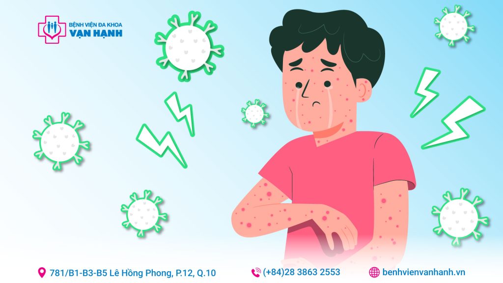 vaccine sởi
